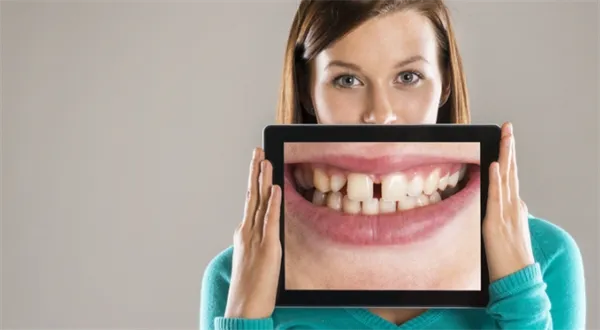 Chvála bankovních poplatků? Proč je neplatit s úsměvem a chutí