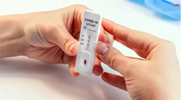 Karanténa a OSVČ. Šance, jak dostat kompenzační bonus, jsou dvě